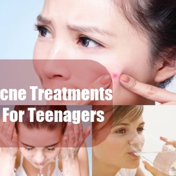 Finding The Best Acne Treatment Methods