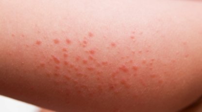 What Causes Itchy Skin